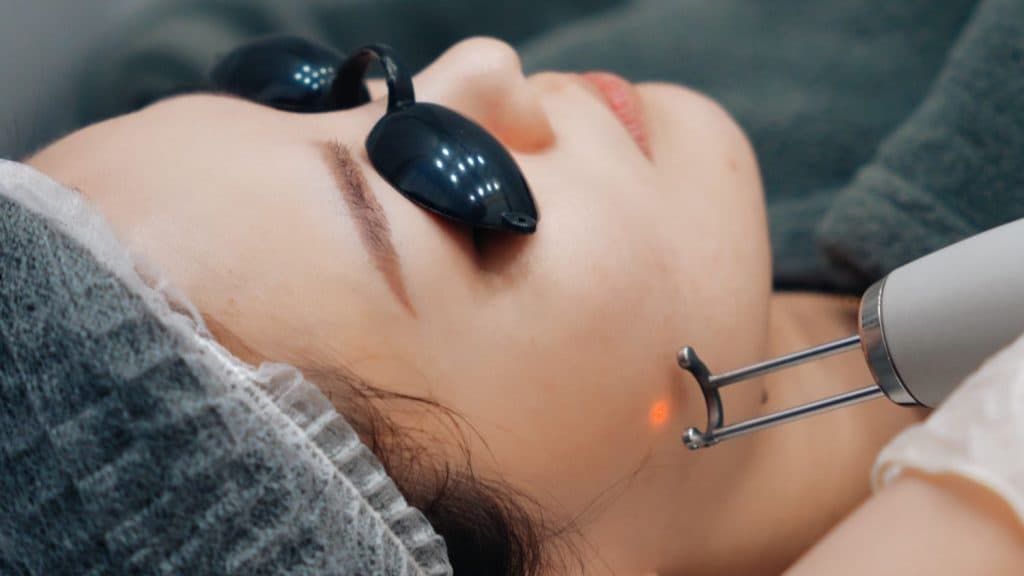Freckle Removal